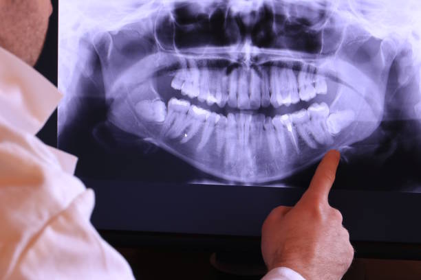 Best Emergency Root Canal Treatment in Scottsboro, AL