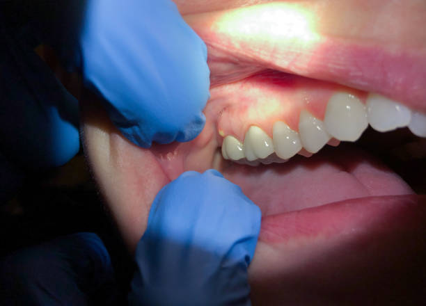 Best Pediatric Emergency Dentist in Scottsboro, AL